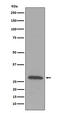 Complement C1q B Chain antibody, M04233, Boster Biological Technology, Western Blot image 