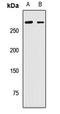 Pre-MRNA Processing Factor 8 antibody, LS-C668111, Lifespan Biosciences, Western Blot image 