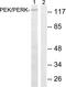 Eukaryotic Translation Initiation Factor 2 Alpha Kinase 3 antibody, LS-C118320, Lifespan Biosciences, Western Blot image 