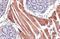 Actin Alpha 2, Smooth Muscle antibody, GTX100034, GeneTex, Immunohistochemistry paraffin image 