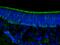 Stathmin 1 antibody, 66090-1-Ig, Proteintech Group, Immunofluorescence image 