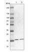 Signal Sequence Receptor Subunit 4 antibody, NBP1-92390, Novus Biologicals, Western Blot image 