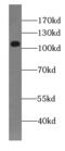 Prominin-1 antibody, FNab01421, FineTest, Western Blot image 