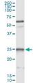Heat Shock Protein Family B (Small) Member 1 antibody, H00003315-M04, Novus Biologicals, Immunoprecipitation image 