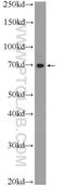 Tetratricopeptide Repeat Domain 30B antibody, 21185-1-AP, Proteintech Group, Western Blot image 