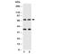 Solute Carrier Family 6 Member 1 antibody, R30811, NSJ Bioreagents, Western Blot image 