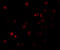 ATPase Phospholipid Transporting 11B (Putative) antibody, 5857, ProSci, Immunofluorescence image 