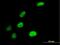 Solute Carrier Family 4 Member 1 Adaptor Protein antibody, H00022950-B01P, Novus Biologicals, Immunocytochemistry image 