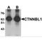 Catenin Beta Like 1 antibody, MBS151352, MyBioSource, Western Blot image 