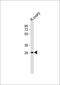 Insulin Like Growth Factor Binding Protein 4 antibody, GTX81639, GeneTex, Western Blot image 