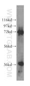 Kelch Like Family Member 22 antibody, 16214-1-AP, Proteintech Group, Western Blot image 