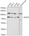 RAD18 E3 Ubiquitin Protein Ligase antibody, 14-988, ProSci, Western Blot image 