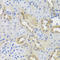 Dipeptidyl peptidase 1 antibody, A02136-1, Boster Biological Technology, Immunohistochemistry paraffin image 