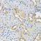 Dipeptidyl transferase antibody, A02136-1, Boster Biological Technology, Immunohistochemistry paraffin image 