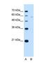 Phosphatidylinositol Glycan Anchor Biosynthesis Class V antibody, NBP1-62449, Novus Biologicals, Western Blot image 