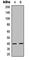 ISL LIM Homeobox 2 antibody, abx133120, Abbexa, Western Blot image 