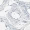 Progesterone Receptor antibody, HPA008428, Atlas Antibodies, Immunohistochemistry frozen image 