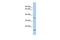 Aspartate Dehydrogenase Domain Containing antibody, GTX45087, GeneTex, Western Blot image 