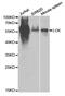 LCK Proto-Oncogene, Src Family Tyrosine Kinase antibody, MBS127476, MyBioSource, Western Blot image 
