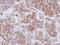 Matrix metalloproteinase-16 antibody, NBP1-33102, Novus Biologicals, Immunohistochemistry paraffin image 