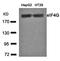 Eukaryotic Translation Initiation Factor 4 Gamma 1 antibody, orb69538, Biorbyt, Western Blot image 