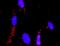 MTK1 antibody, H00004216-M06, Novus Biologicals, Proximity Ligation Assay image 