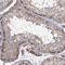 CKLF-like MARVEL transmembrane domain-containing protein 3 antibody, HPA072695, Atlas Antibodies, Immunohistochemistry frozen image 