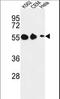 Galanin Receptor 1 antibody, LS-C166365, Lifespan Biosciences, Western Blot image 