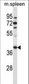 Tubulin Folding Cofactor C antibody, LS-C161738, Lifespan Biosciences, Western Blot image 
