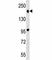 Tet Methylcytosine Dioxygenase 2 antibody, F45578-0.4ML, NSJ Bioreagents, Western Blot image 