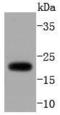 ADP Ribosylation Factor 1 antibody, A01279-1, Boster Biological Technology, Western Blot image 