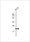 Apolipoprotein B MRNA Editing Enzyme Catalytic Subunit 3C antibody, 61-357, ProSci, Western Blot image 