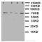 Mitogen-Activated Protein Kinase Kinase Kinase 3 antibody, orb97050, Biorbyt, Western Blot image 
