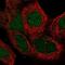 Alpha-mannosidase 2C1 antibody, NBP2-57246, Novus Biologicals, Immunocytochemistry image 