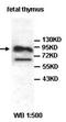 Acyl-CoA Binding Domain Containing 7 antibody, orb77640, Biorbyt, Western Blot image 