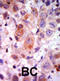 G Protein-Coupled Receptor Kinase 2 antibody, abx033109, Abbexa, Immunohistochemistry frozen image 