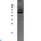 Solute Carrier Family 22 Member 6 antibody, LS-C814184, Lifespan Biosciences, Western Blot image 