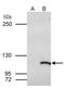 SWI/SNF Related, Matrix Associated, Actin Dependent Regulator Of Chromatin, Subfamily A Like 1 antibody, NBP2-20414, Novus Biologicals, Immunoprecipitation image 