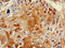 Tetratricopeptide repeat protein 19 antibody, LS-C672868, Lifespan Biosciences, Immunohistochemistry paraffin image 