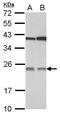 Transmembrane emp24 domain-containing protein 7 antibody, NBP2-15141, Novus Biologicals, Western Blot image 