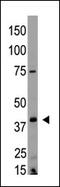 Lysophosphatidic acid receptor 2 antibody, AP13103PU-N, Origene, Western Blot image 