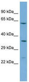 LDL Receptor Related Protein 11 antibody, TA339632, Origene, Western Blot image 