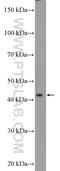 Single Stranded DNA Binding Protein 4 antibody, 15595-1-AP, Proteintech Group, Western Blot image 