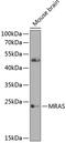 Muscle RAS Oncogene Homolog antibody, 23-505, ProSci, Western Blot image 