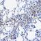 UBE2I antibody, GTX55830, GeneTex, Immunohistochemistry paraffin image 