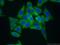 Alanyl-TRNA Synthetase antibody, 17394-1-AP, Proteintech Group, Immunofluorescence image 