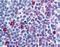 C-C chemokine receptor type 8 antibody, orb85079, Biorbyt, Immunohistochemistry paraffin image 