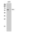 Checkpoint Kinase 2 antibody, STJ92270, St John