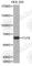 Alpha-(1,6)-fucosyltransferase antibody, A3201, ABclonal Technology, Western Blot image 