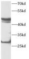 Platelet Derived Growth Factor D antibody, FNab06265, FineTest, Western Blot image 